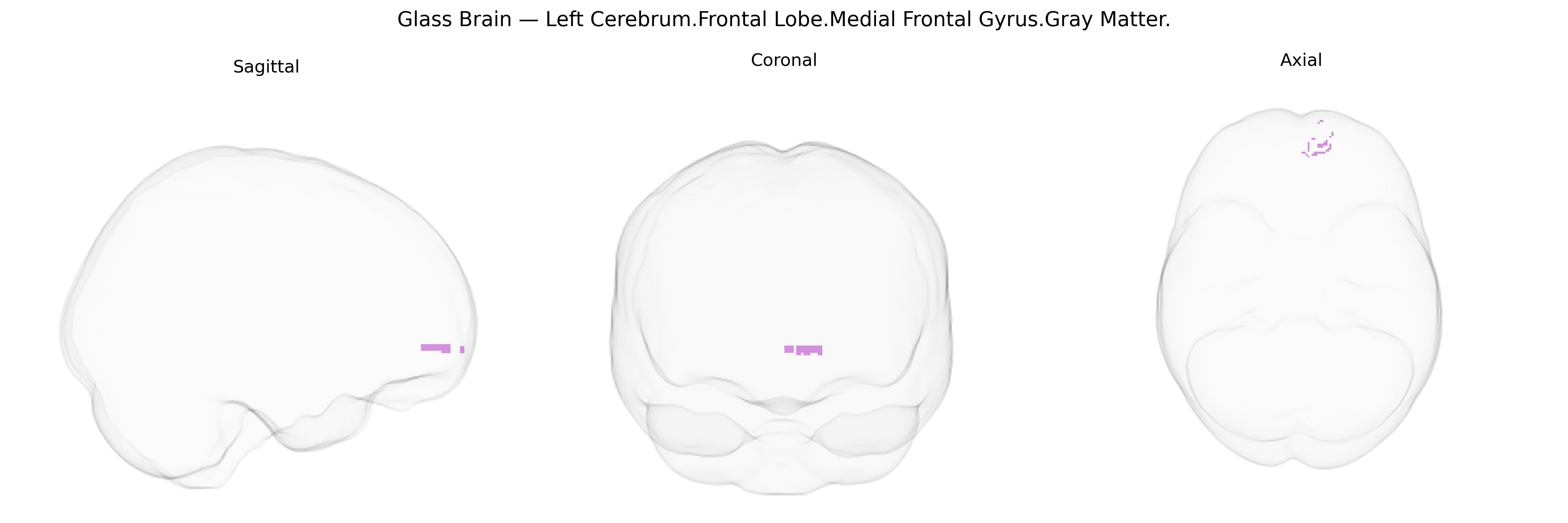 Triplanar Ghost Brain