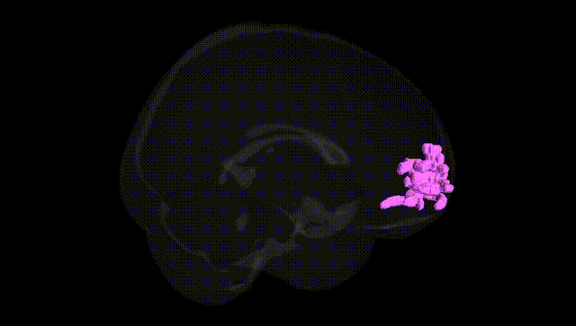 Full Brain Black