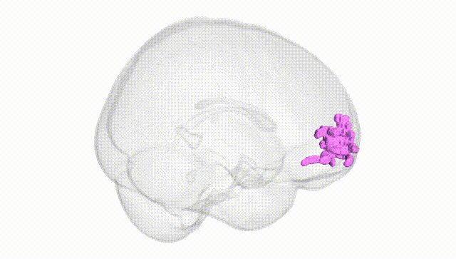 Full Brain White