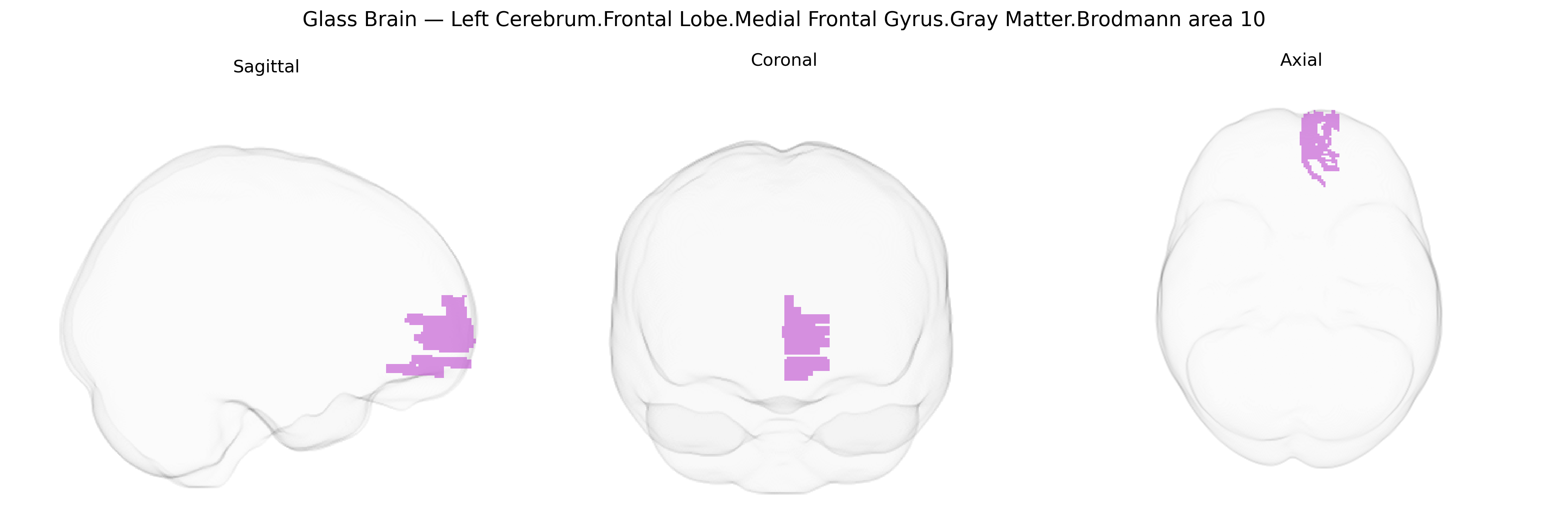 Triplanar Ghost Brain