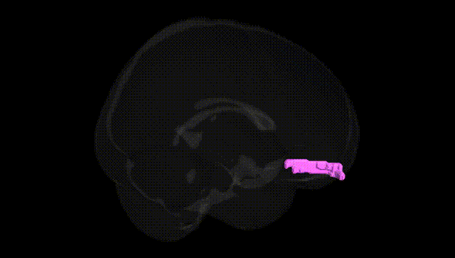 Full Brain Black