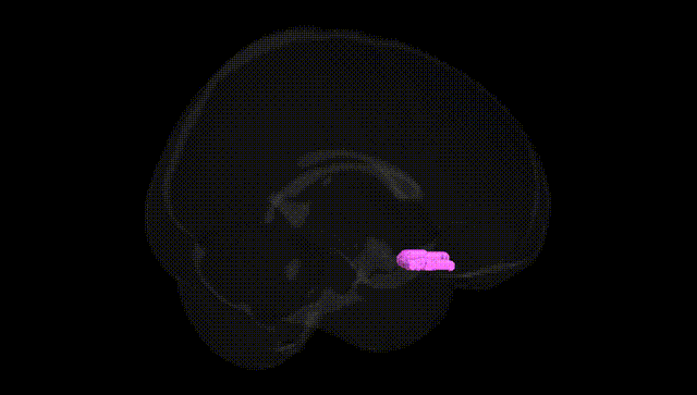 Full Brain Black