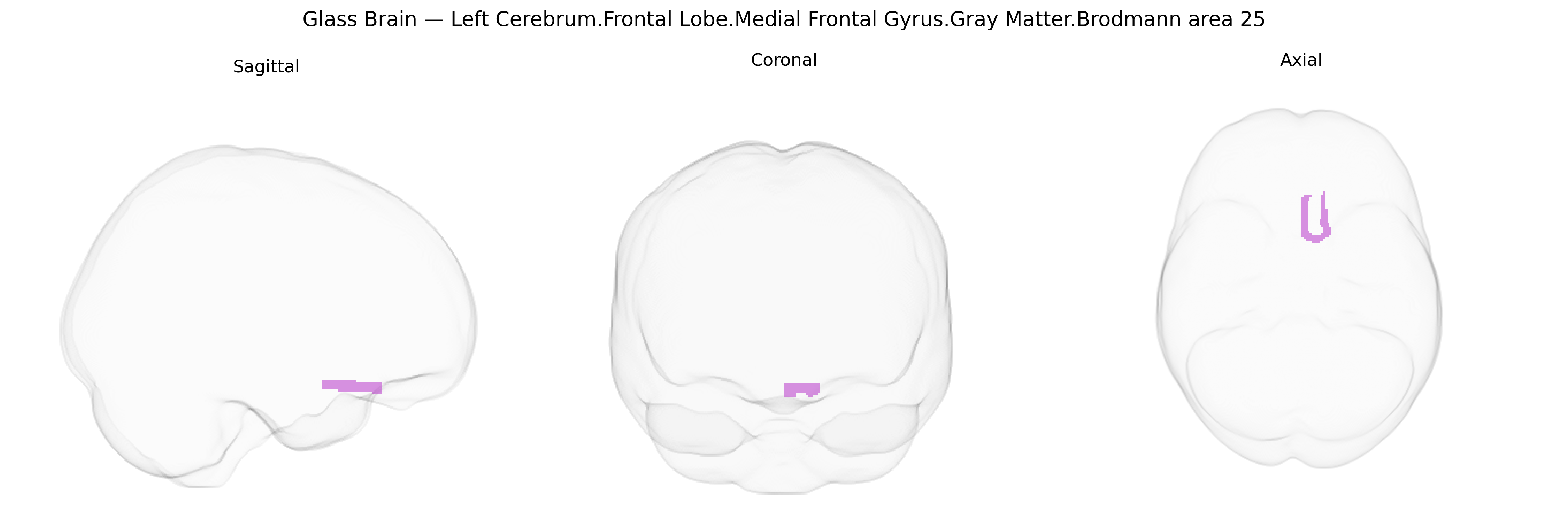 Triplanar Ghost Brain