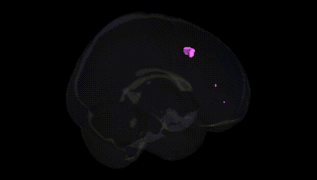 Full Brain Black