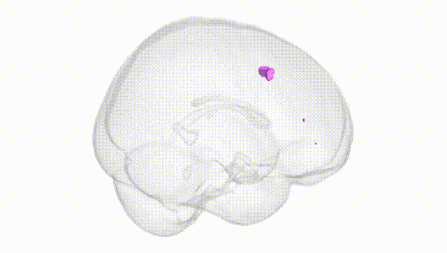 Full Brain White