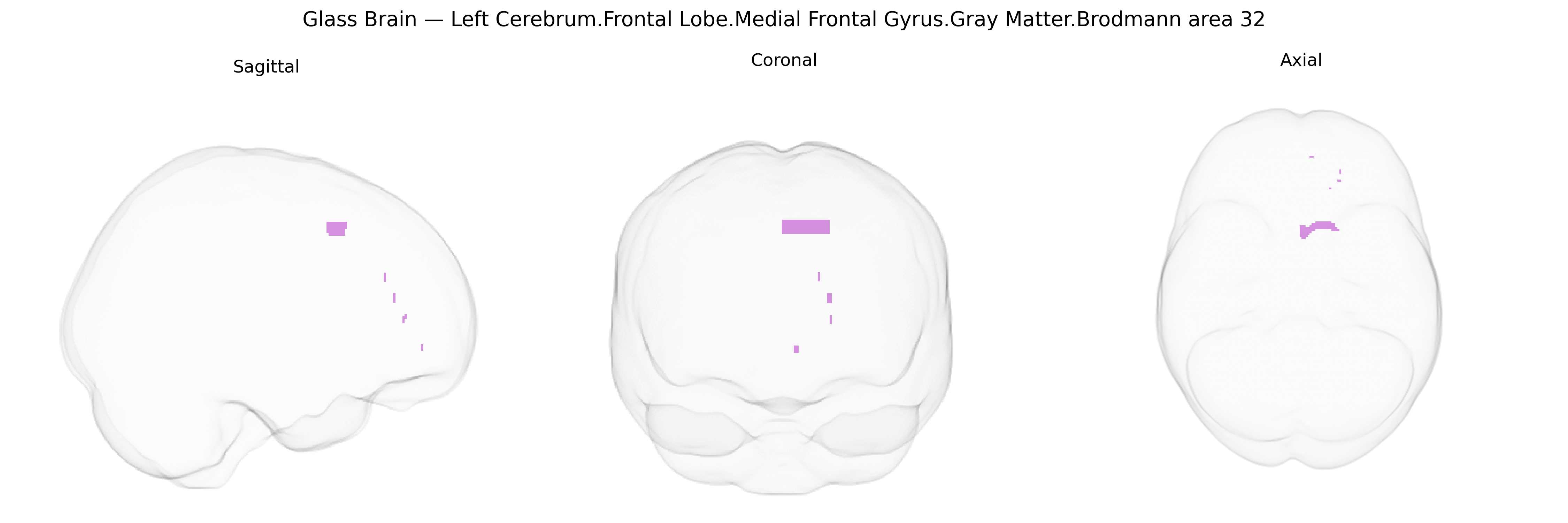 Triplanar Ghost Brain
