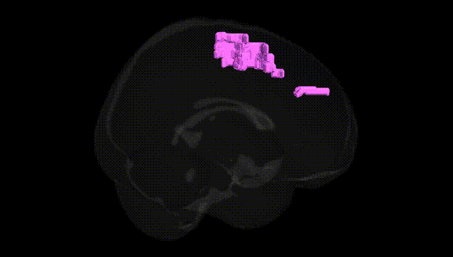 Full Brain Black
