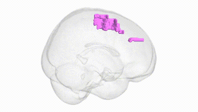Full Brain White