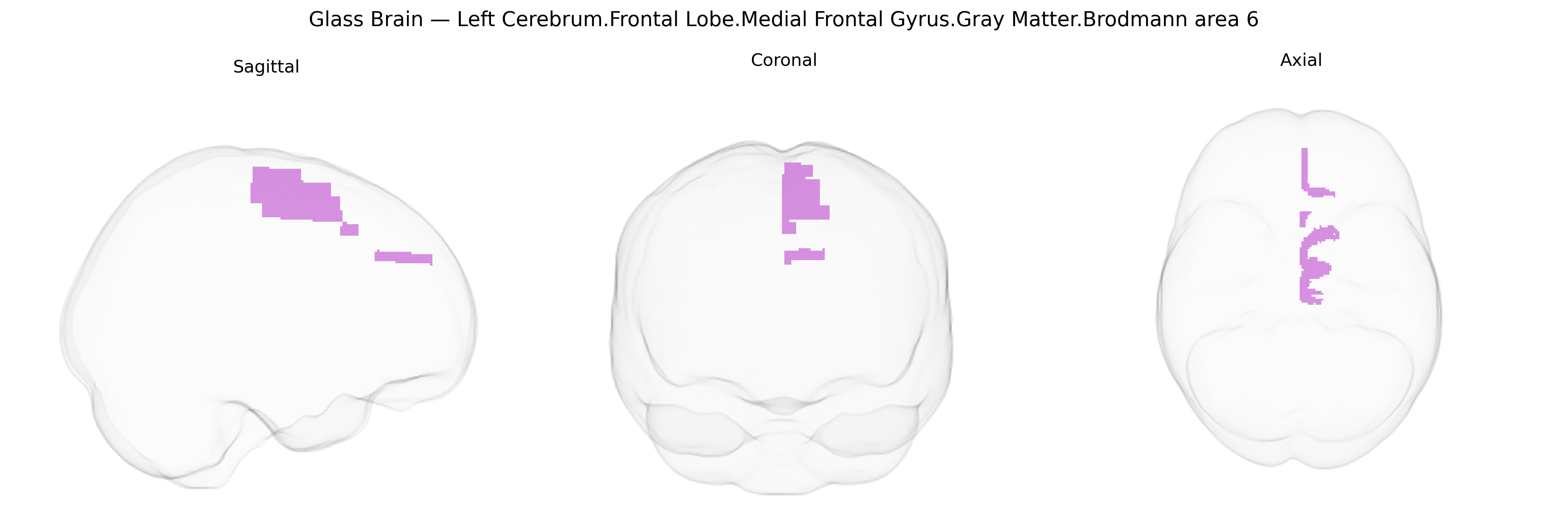 Triplanar Ghost Brain