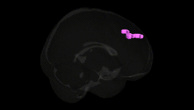 Full Brain Black
