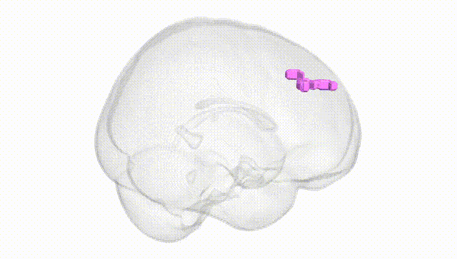 Full Brain White