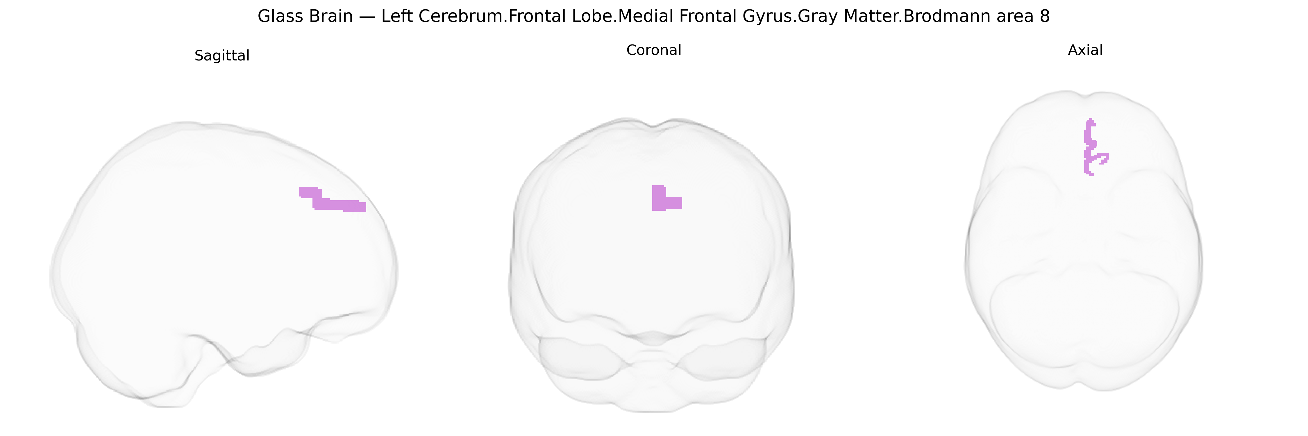 Triplanar Ghost Brain