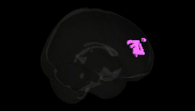 Full Brain Black