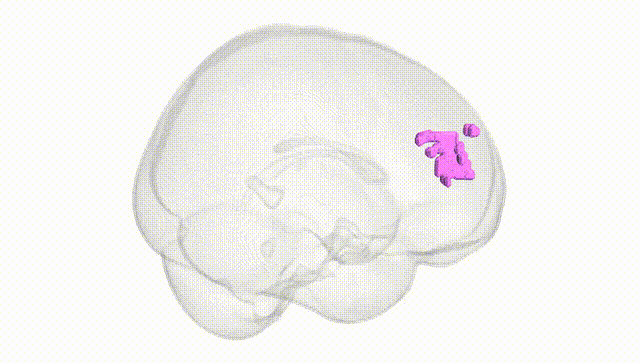 Full Brain White