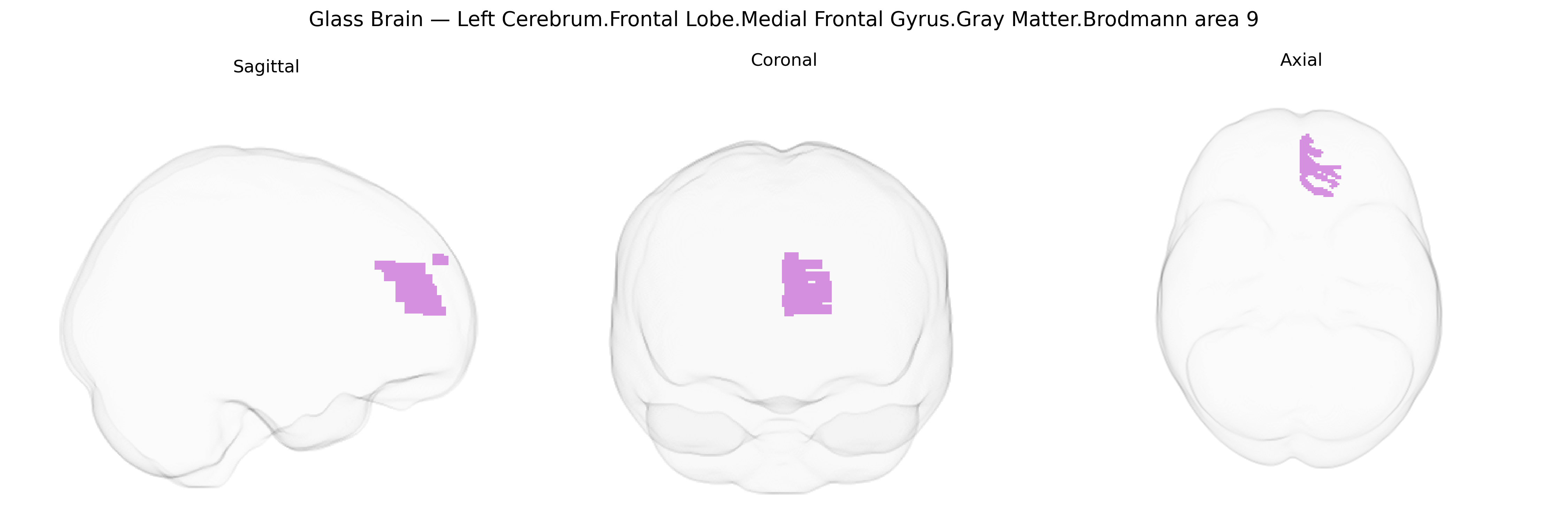 Triplanar Ghost Brain