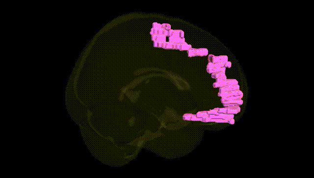 Full Brain Black
