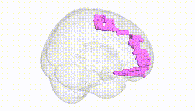 Full Brain White