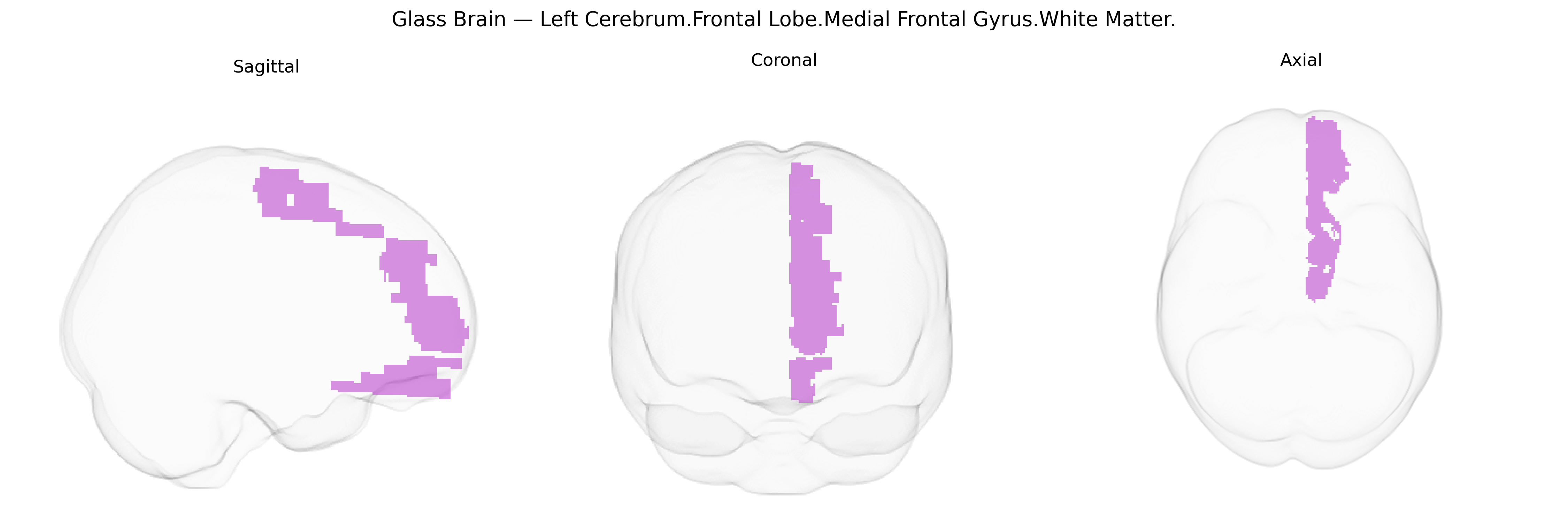 Triplanar Ghost Brain