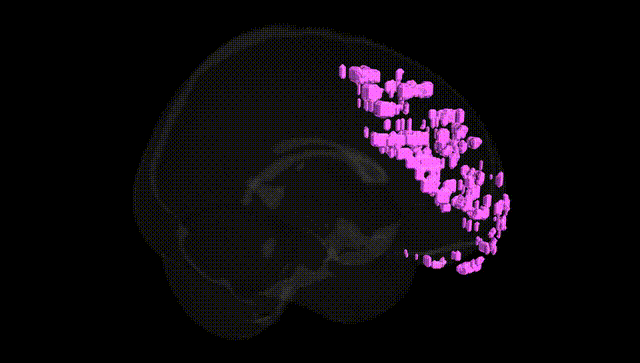 Full Brain Black