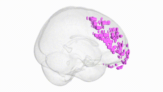 Full Brain White