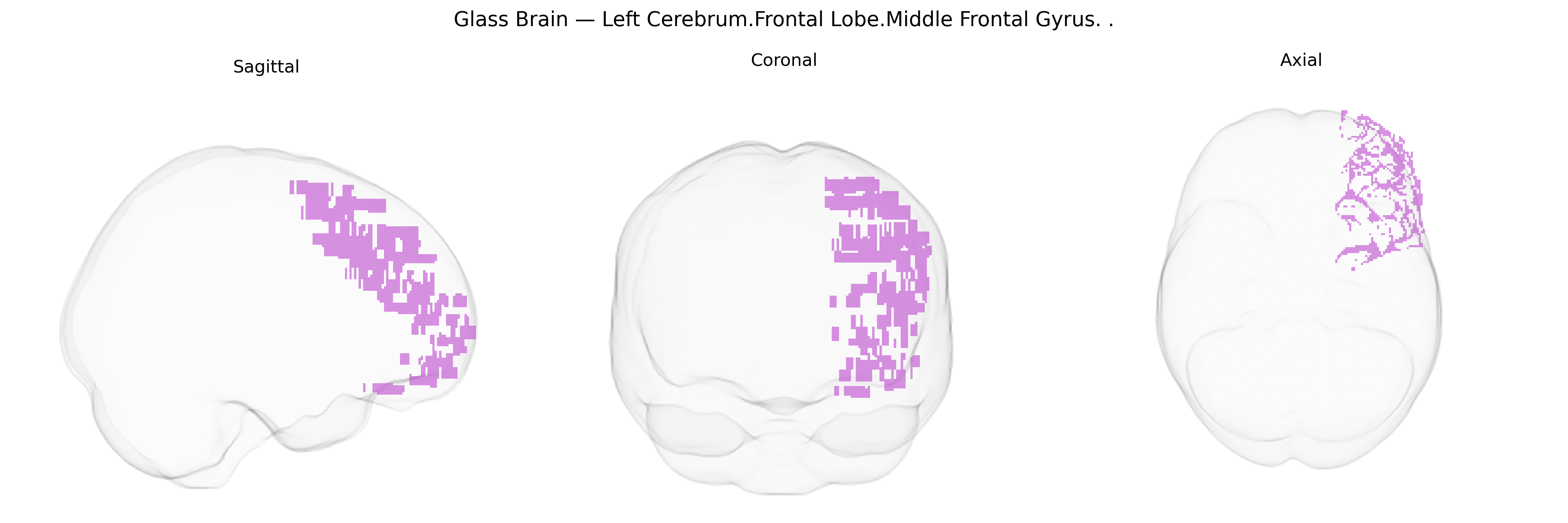 Triplanar Ghost Brain