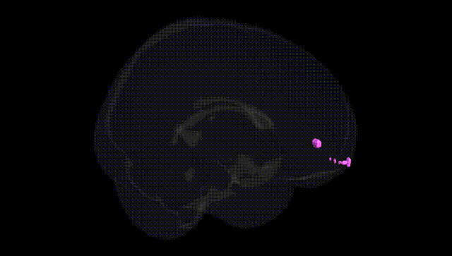 Full Brain Black