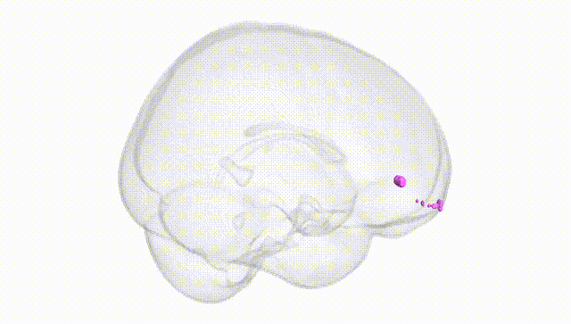 Full Brain White
