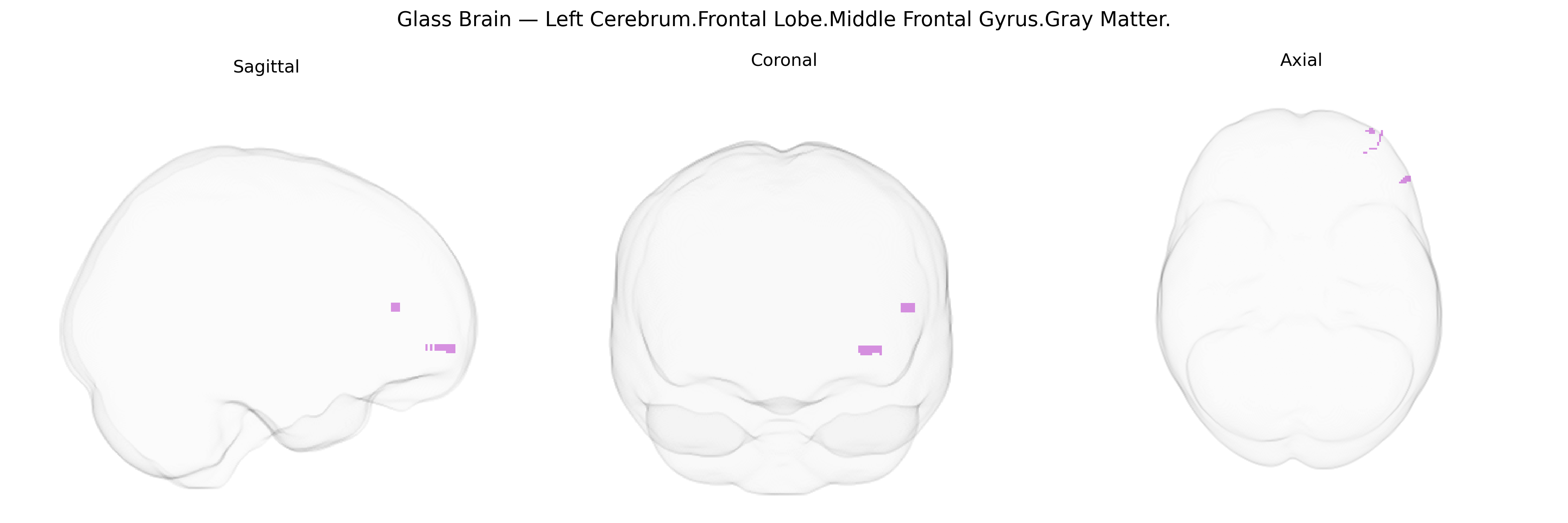 Triplanar Ghost Brain