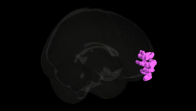 Full Brain Black