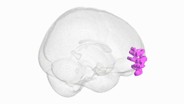 Full Brain White