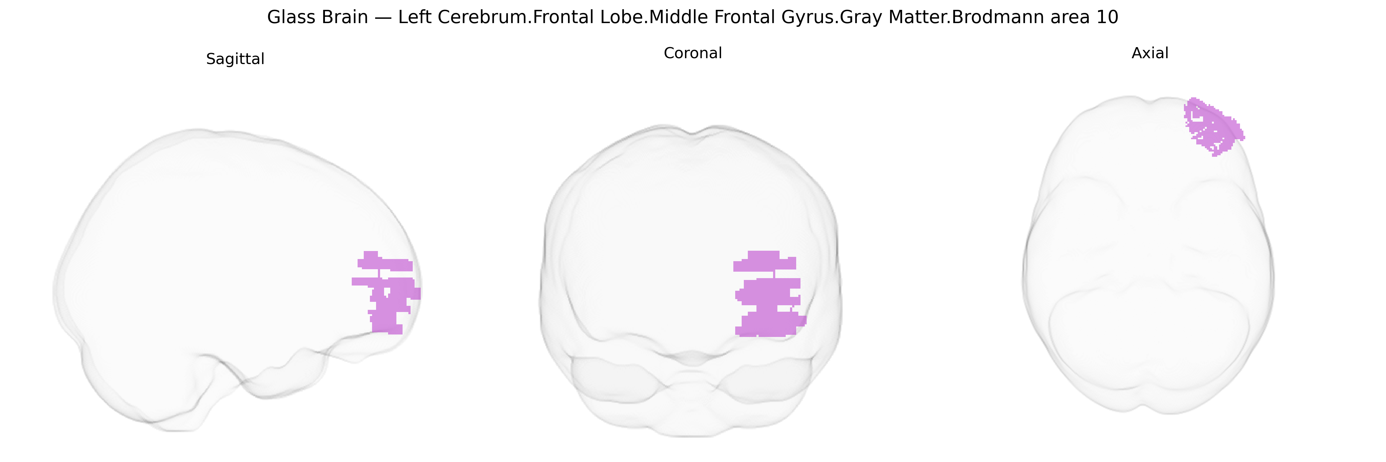 Triplanar Ghost Brain