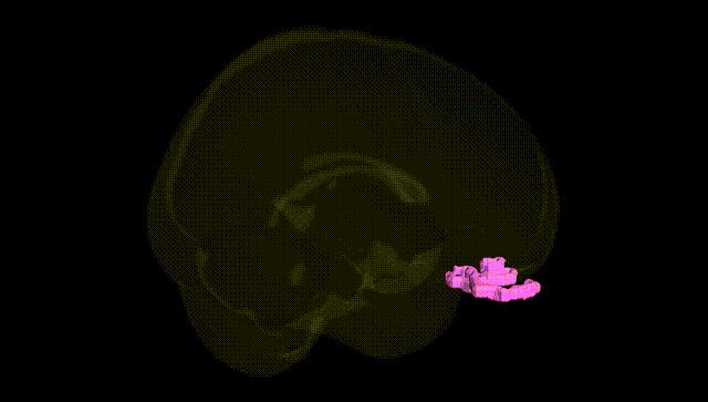 Full Brain Black