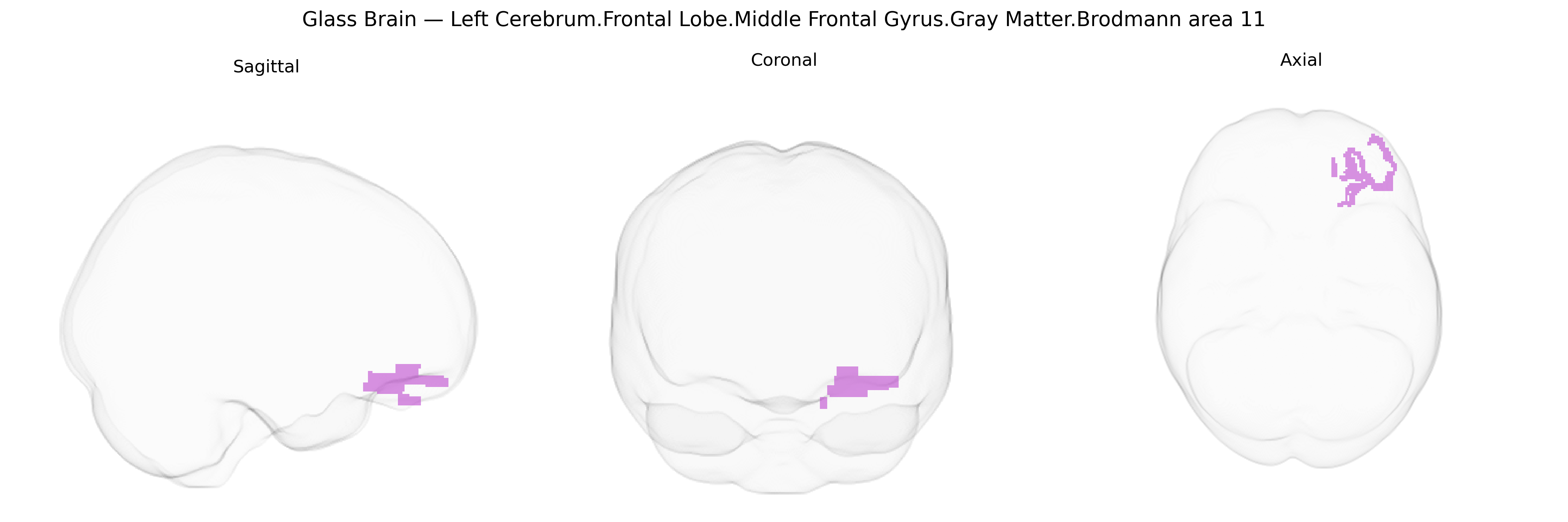 Triplanar Ghost Brain