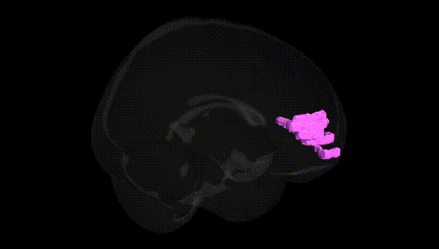 Full Brain Black