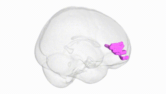 Full Brain White