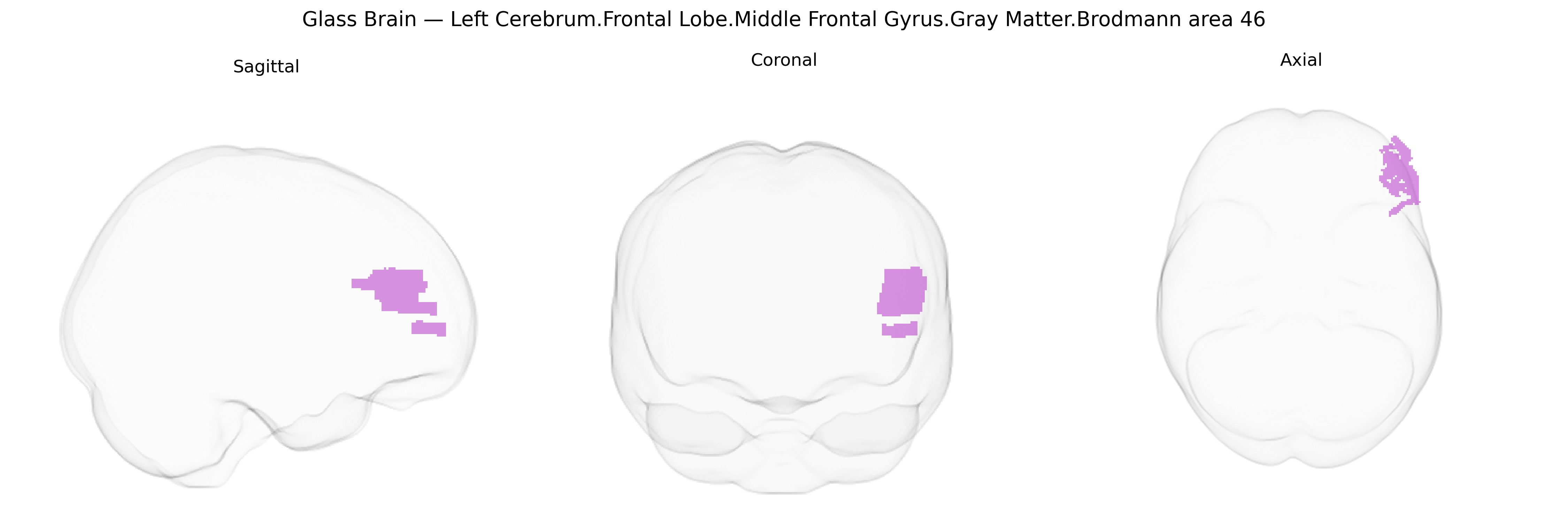 Triplanar Ghost Brain