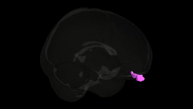 Full Brain Black