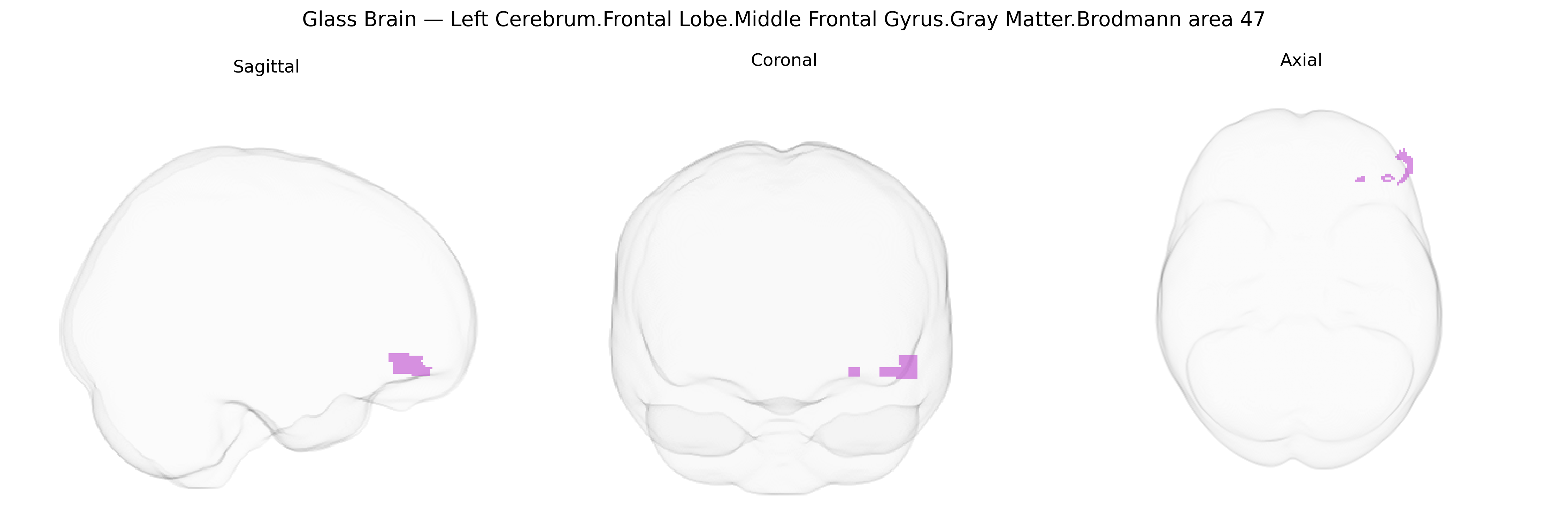 Triplanar Ghost Brain