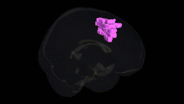 Full Brain Black
