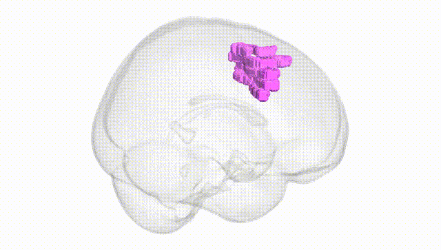 Full Brain White