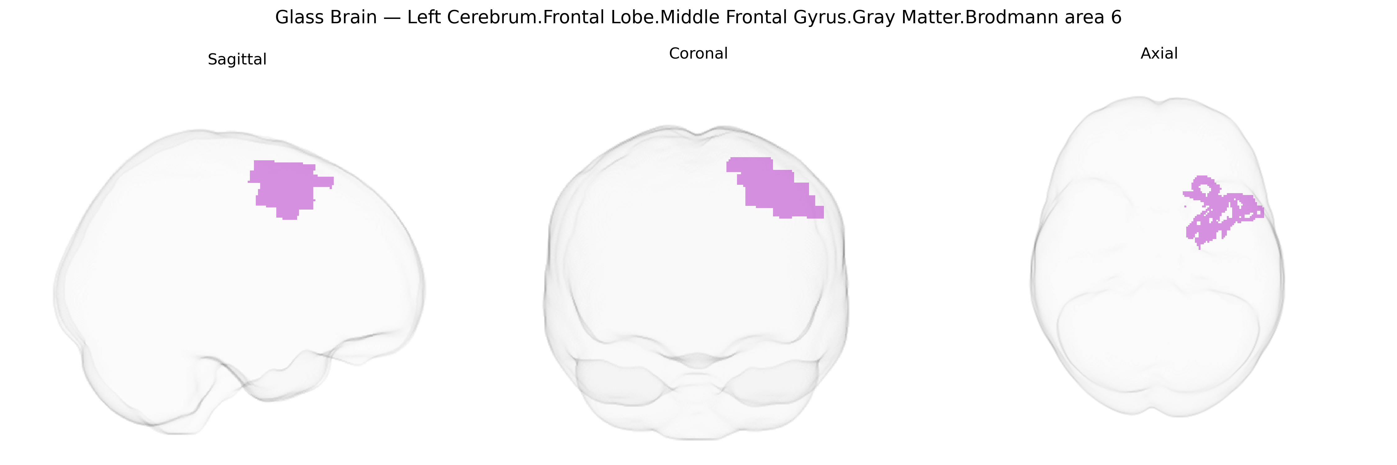 Triplanar Ghost Brain