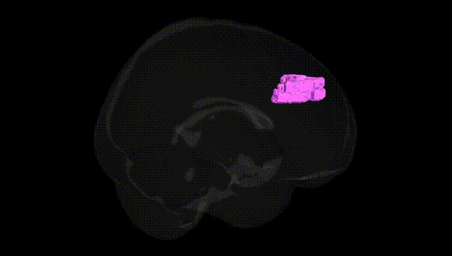 Full Brain Black