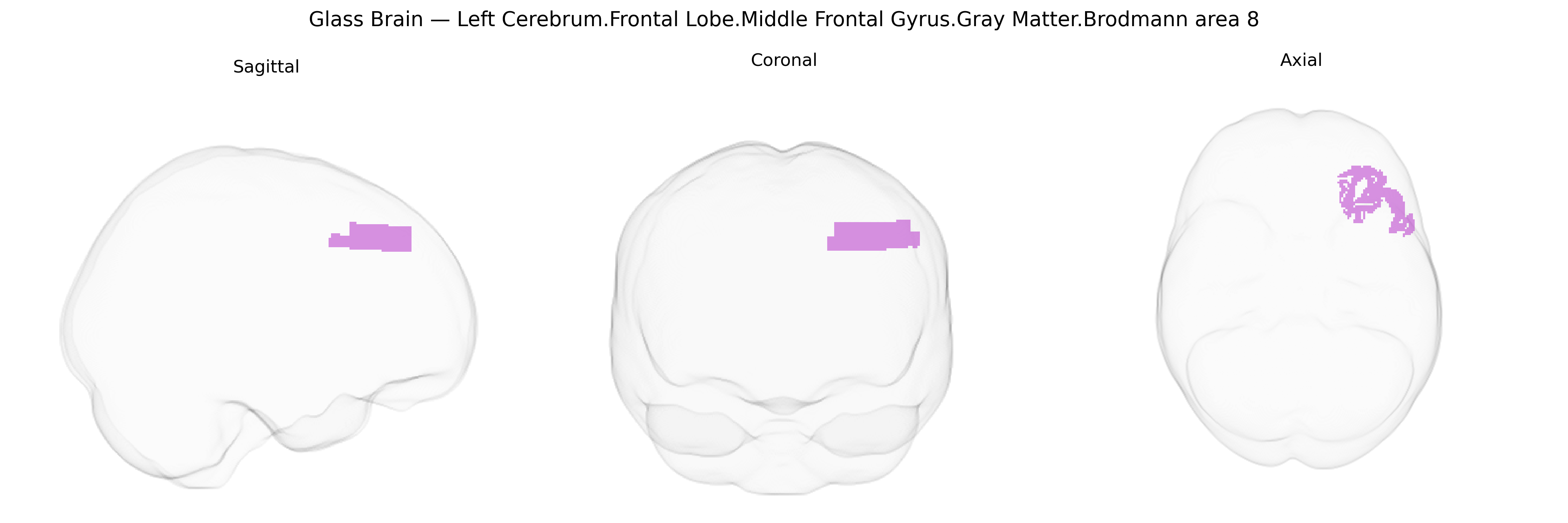 Triplanar Ghost Brain