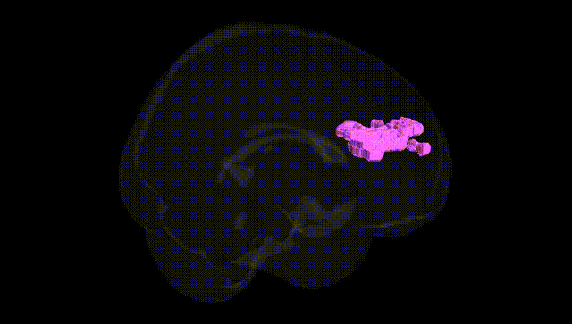 Full Brain Black