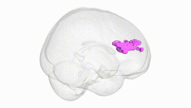 Full Brain White