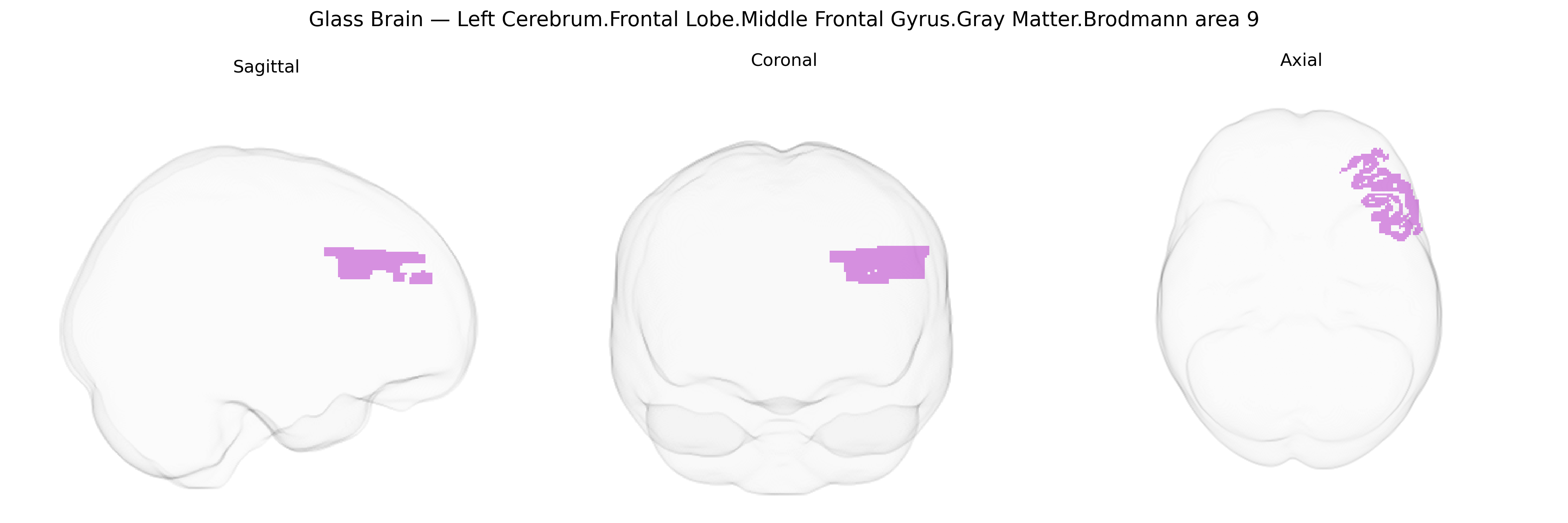 Triplanar Ghost Brain