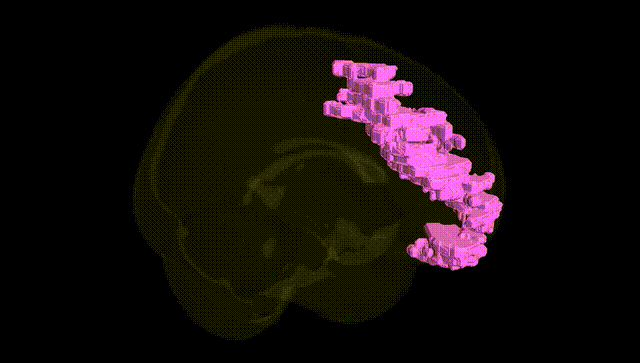 Full Brain Black