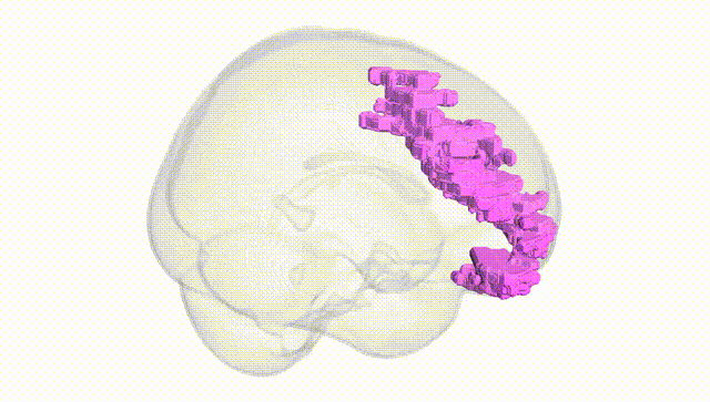 Full Brain White