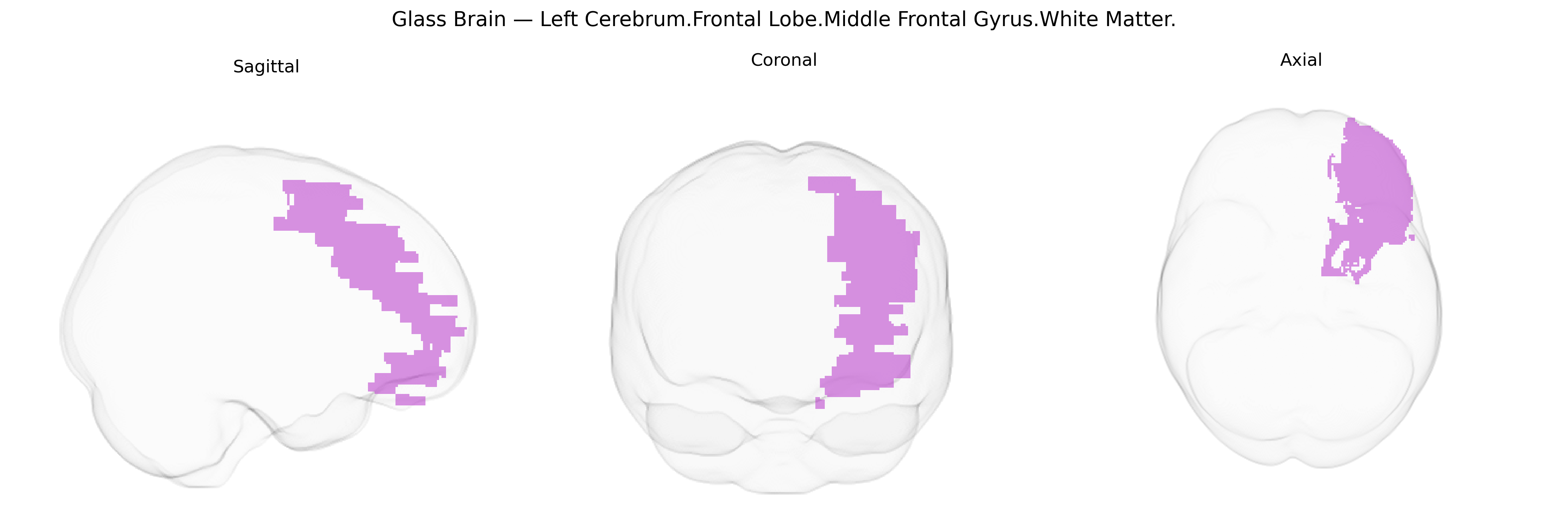 Triplanar Ghost Brain