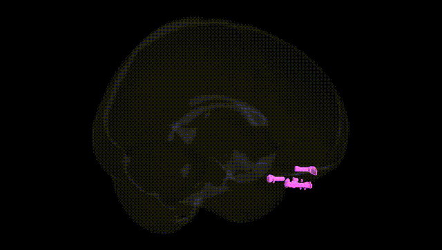 Full Brain Black